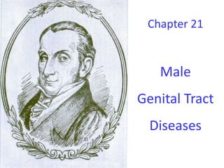 Chapter 21
Male
Genital Tract
Diseases
 