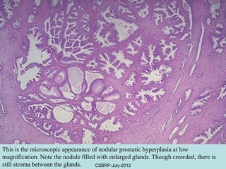 Male genitaltract 4 | PDF