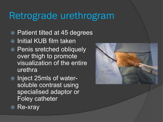 Retrograde urethrogram
 Patient tilted at 45 degrees
 Initial KUB film taken
 Penis sretched obliquely
over thigh to promote
visualization of the entire
urethra
 Inject 25mls of water-
soluble contrast using
specialised adaptor or
Foley catheter
 Re-xray
 