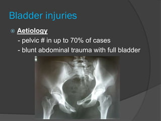Bladder injuries
 Aetiology
- pelvic # in up to 70% of cases
- blunt abdominal trauma with full bladder
 