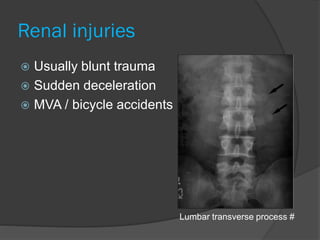 Renal injuries
 Usually blunt trauma
 Sudden deceleration
 MVA / bicycle accidents
Lumbar transverse process #
 