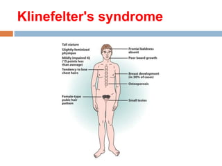 Male hypogonadism | PPT