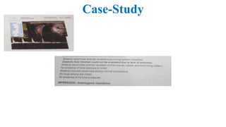 Case-Study
 