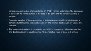 Pge1 Injection MALE INFERTILITY AND ERECTILE DYSFUNCTION | PPTX