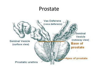 Prostate
 