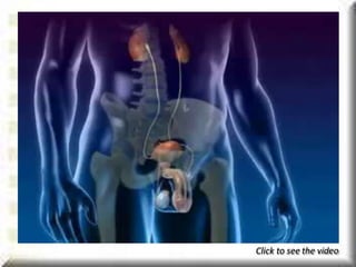 Click to see the video
 