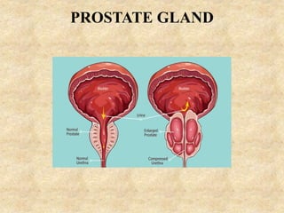 Prostata In English MALE REPRODUCTIVE SYSTEM.pptx