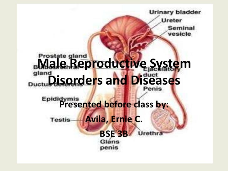 male reproductive system disorders and diseases reproductive system diseases