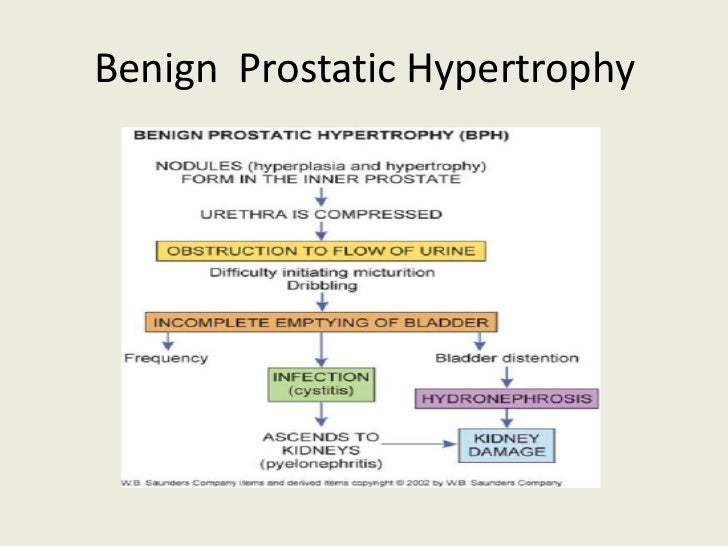 male reproductive system disorders and diseases reproductive system diseases