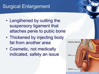 Surgical Enlargement

 • Lengthened by cutting the
   suspensory ligament that
   attaches penis to pubic bone
 • Thickened by injecting body
   fat from another area
 • Cosmetic, not medically
   indicated, safety an issue
 