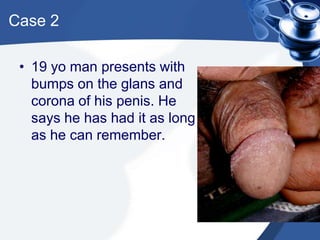 Case 2

 • 19 yo man presents with
   bumps on the glans and
   corona of his penis. He
   says he has had it as long
   as he can remember.
 