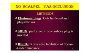 Male sterilization- A SHORT NOTE