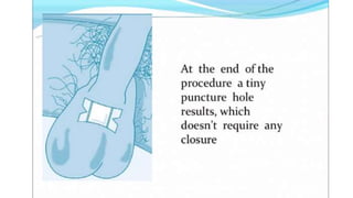 Male sterilization- A SHORT NOTE