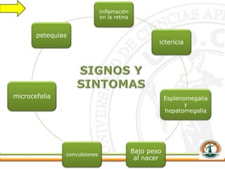 Inflamación
en la retina
ictericia
Esplenomegalia
y
hepatomegalia
Bajo peso
al nacer
convulsiones
microcefalia
petequias
 
