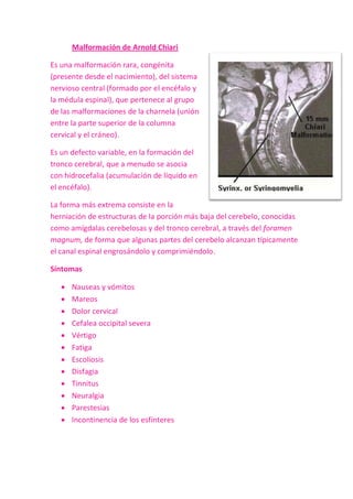 Malformación de Arnold Chiari

Es una malformación rara, congénita
(presente desde el nacimiento), del sistema
nervioso central (formado por el encéfalo y
la médula espinal), que pertenece al grupo
de las malformaciones de la charnela (unión
entre la parte superior de la columna
cervical y el cráneo).

Es un defecto variable, en la formación del
tronco cerebral, que a menudo se asocia
con hidrocefalia (acumulación de líquido en
el encéfalo).

La forma más extrema consiste en la
herniación de estructuras de la porción más baja del cerebelo, conocidas
como amígdalas cerebelosas y del tronco cerebral, a través del foramen
magnum, de forma que algunas partes del cerebelo alcanzan típicamente
el canal espinal engrosándolo y comprimiéndolo.

Síntomas

      Nauseas y vómitos
      Mareos
      Dolor cervical
      Cefalea occipital severa
      Vértigo
      Fatiga
      Escoliosis
      Disfagia
      Tinnitus
      Neuralgia
      Parestesias
      Incontinencia de los esfínteres
 