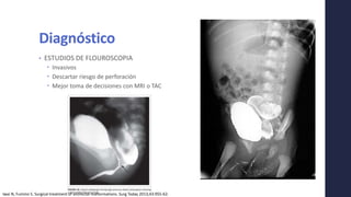 Diagnóstico
• ESTUDIOS DE FLOUROSCOPIA
 Invasivos
 Descartar riesgo de perforación
 Mejor toma de decisiones con MRI o TAC
Iwai N, Fumino S. Surgical treatment of anorectal malformations. Surg Today 2013;43:955-62.
 
