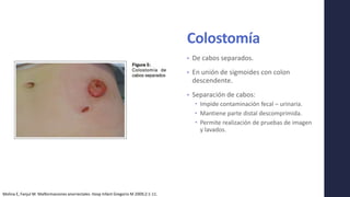 Colostomía
• De cabos separados.
• En unión de sigmoides con colon
descendente.
• Separación de cabos:
 Impide contaminación fecal – urinaria.
 Mantiene parte distal descomprimida.
 Permite realización de pruebas de imagen
y lavados.
Molina E, Fanjul M. Malformaciones anorrectales. Hosp Infant Gregorio M 2009;2:1-11.
 