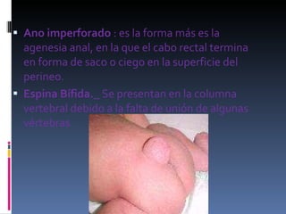 Ano imperforado  : es la forma más es la agenesia anal, en la que el cabo rectal termina en forma de saco o ciego en la superficie del perineo. Espina Bífida._  Se presentan en la columna vertebral debido a la falta de unión de algunas vértebras.  