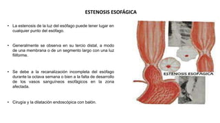 Malformacion De Tubo Digestivo pptx malformacion-de-tubo-digestivo-pptx