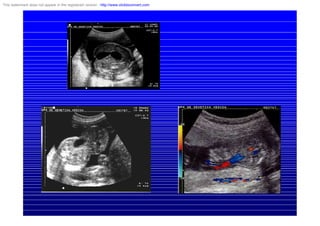 This watermark does not appear in the registered version - http://www.clicktoconvert.com
 