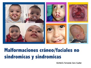+
Malformaciones cráneo/faciales no
sindromicas y sindromicas
Od.María Fernanda Caro Cuellar
 