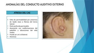 Malformaciones pptx Y Su Tratamiento Y Manejo PPTX Malformaciones pptx Y Su Tratamiento Y Manejo PPTX
