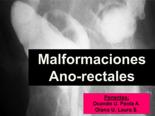 Malformaciones
Ano-rectales
Ponentes:
Ocando U. Paola A.
Olano U. Laura S.

 