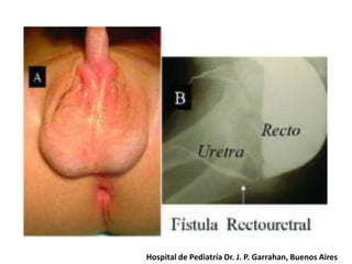 Hospital de Pediatría Dr. J. P. Garrahan, Buenos Aires

 