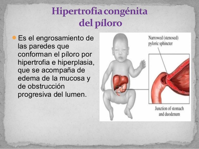 Malformaciones DEL APARATO DIGESTIVO