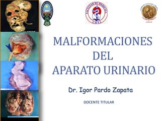MALFORMACIONES
DEL
APARATO URINARIO
Dr. Igor Pardo Zapata
DOCENTE TITULAR
 
