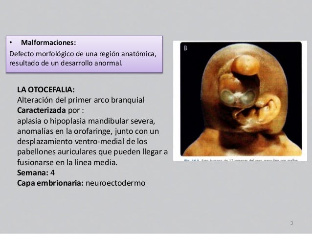 malformaciones embriologia