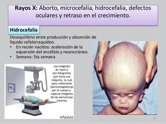 malformaciones embriologia