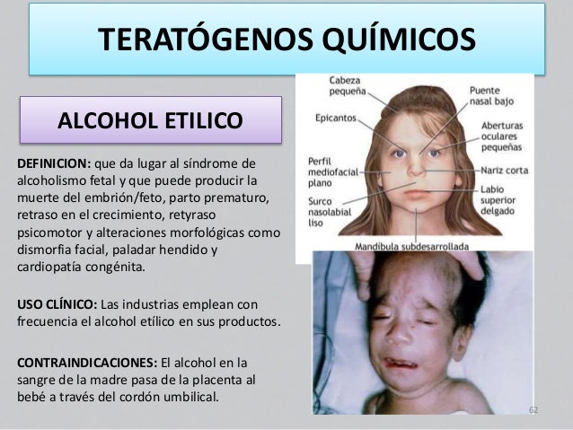 El alcoholismo de cerveza en la psiquiatría
