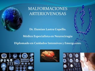 .
MALFORMACIONES
ARTERIOVENOSAS
Dr. Damian Lastra Copello.
Médico Especialista en Neurocirugía
Diplomado en Cuidados Intensivos y Emergentes.
 