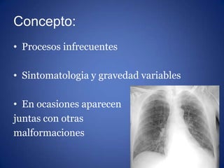 Concepto:
• Procesos infrecuentes
• Sintomatologia y gravedad variables
• En ocasiones aparecen
juntas con otras
malformac...