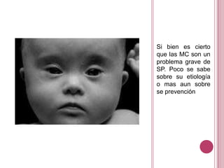 Si bien es cierto
que las MC son un
problema grave de
SP. Poco se sabe
sobre su etiología
o mas aun sobre
se prevención
 