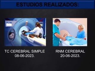 ESTUDIOS REALIZADOS:
TC CEREBRAL SIMPLE
08-06-2023.
RNM CEREBRAL
20-06-2023.
 