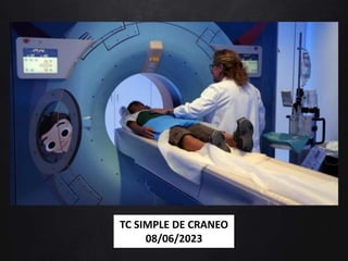 TC SIMPLE DE CRANEO
08/06/2023
 