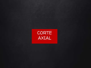 CORTE
AXIAL
 