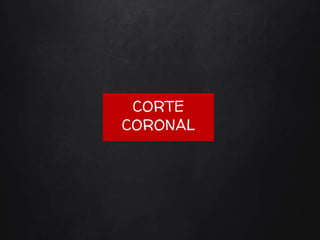 CORTE
CORONAL
 