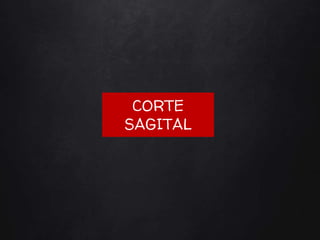 CORTE
SAGITAL
 