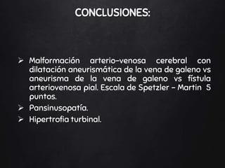  Malformación arterio-venosa cerebral con
dilatación aneurismática de la vena de galeno vs
aneurisma de la vena de galeno vs fístula
arteriovenosa pial. Escala de Spetzler – Martin 5
puntos.
 Pansinusopatía.
 Hipertrofia turbinal.
CONCLUSIONES:
 