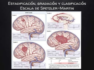 Estadificación, gradación y clasificación
Escala de Spetzler-Martin
 