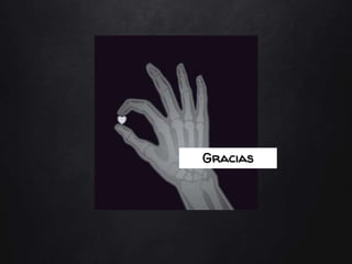 Gracias
 