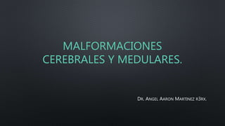 MALFORMACIONES
CEREBRALES Y MEDULARES.
DR. ANGEL AARON MARTINEZ R3RX.
 