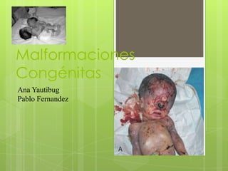 Malformaciones
Congénitas
Ana Yautibug
Pablo Fernandez
 