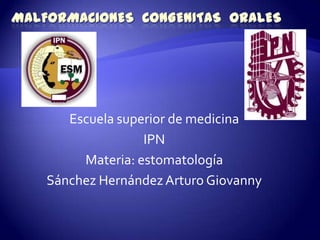 Malformaciones CONGENITAS  ORALES Escuela superior de medicina IPN Materia: estomatología Sánchez Hernández Arturo Giovanny 