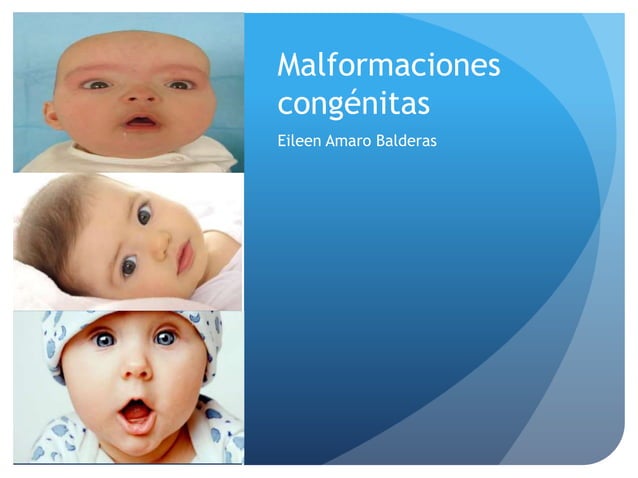 Malformaciones congénitas y tumores | PPT