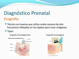 Diagnóstico Prenatal
Ecografía
Técnica no invasiva que utiliza ondas sonoras de alta
 frecuencia reflejadas en los tejidos para crear imágenes.
Tipos:
    Ecografía Transabdominal          Ecografía Transvaginal
 