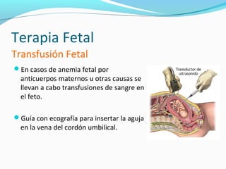 Terapia Fetal
Transfusión Fetal
En casos de anemia fetal por
  anticuerpos maternos u otras causas se
  llevan a cabo transfusiones de sangre en
  el feto.

Guía con ecografía para insertar la aguja
  en la vena del cordón umbilical.
 